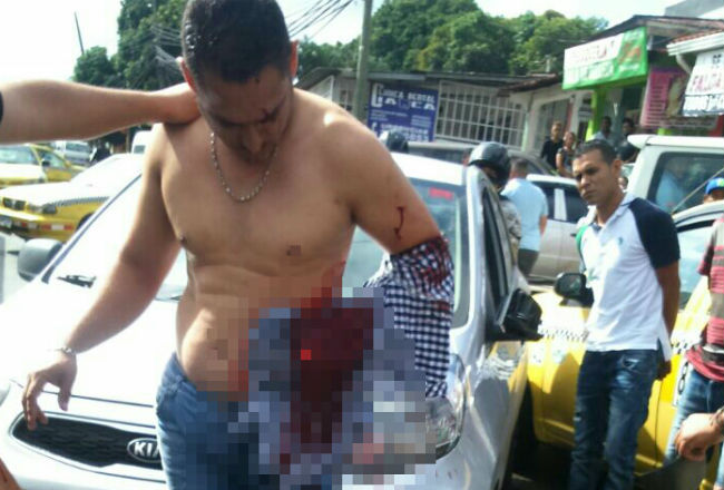 Apuñalan a hombre luego de una disputa por colisión Día a Día