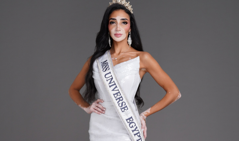 Logina Salah se convierte en la primera Miss Egipto con vitiligo 