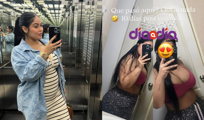 Tatiana Durango muestra con orgullo su cuerpo post cesárea 