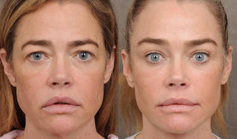 Denise Richards reaparece con un cambio sutil que resalta su esencia 