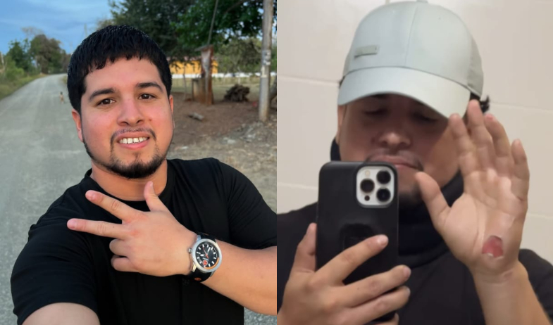 ¡Casi no la cuenta! Frank De León sufre accidente en moto 