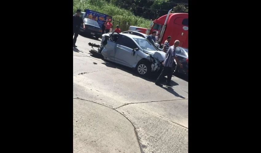 Accidente de transito por el  Rod Carew.