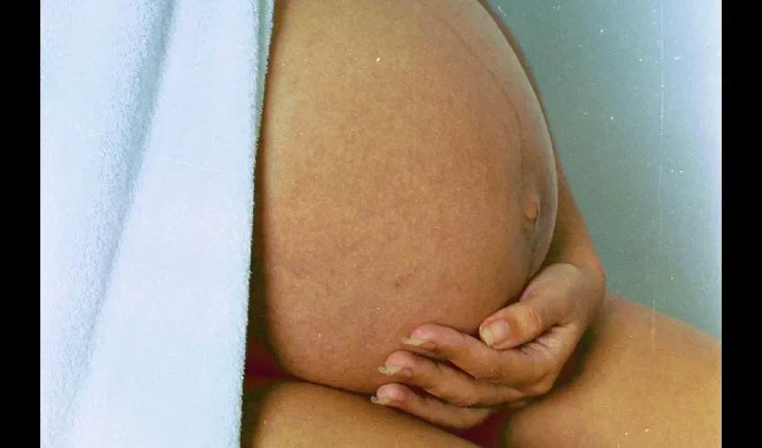 El 80% de las personas son asintomáticas al virus.