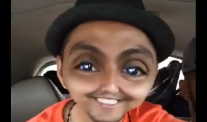 Alex Pro, el hermano de Flex, contagiado Archivo