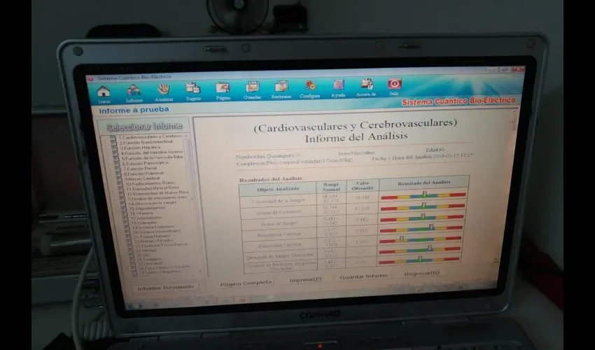 El proceso de escaneo tarda un minuto en hacer su trabajo. Foto: Jean Carlos Díaz