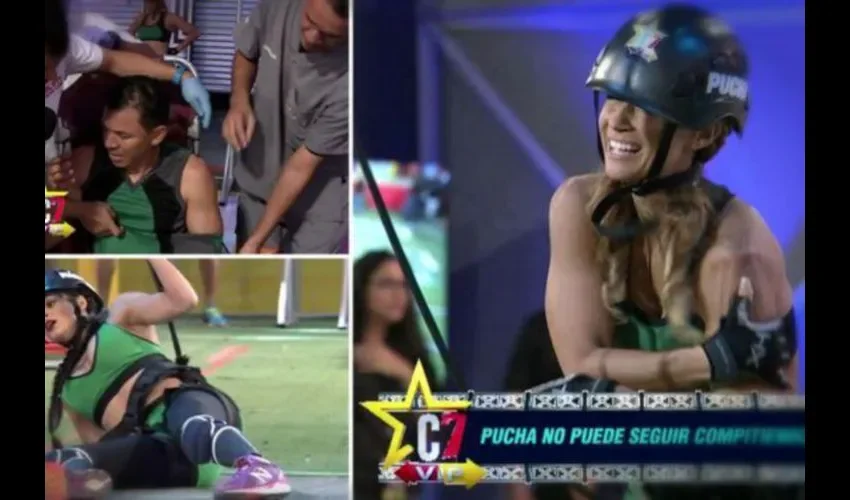 "Pucha" se someterá a terapia, durante los tres meses de recuperación, todo en pro de volver a su deporte principal que es el "surf", y poder tener una movilidad óptima en su brazo.