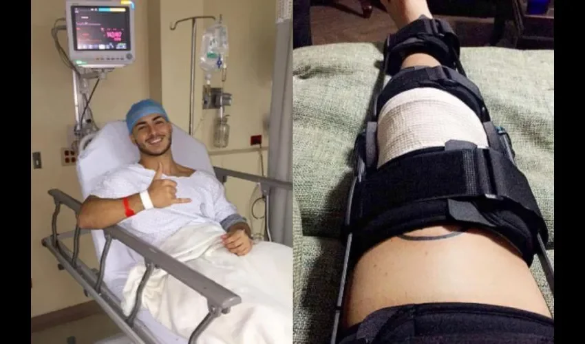 Cuando salió de su operación Instagram