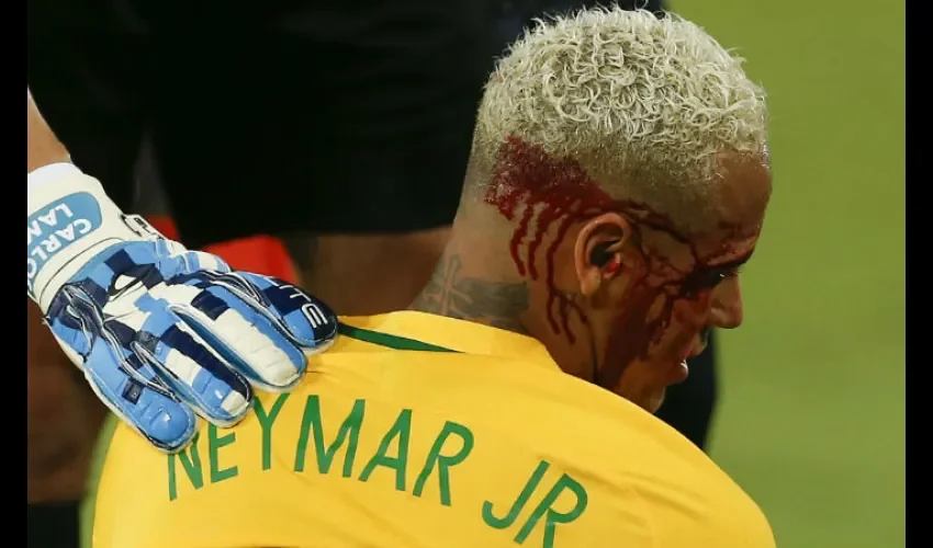 Neymar al momento de abandonar el juego./ Foto AP