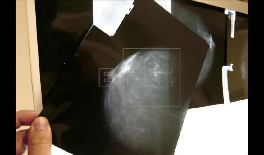 Estudios para combatir el cáncer 