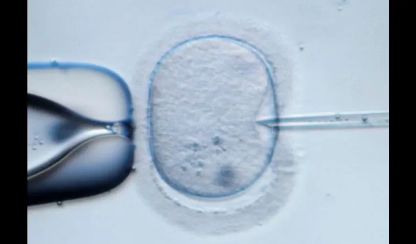 Fecundación in vitro