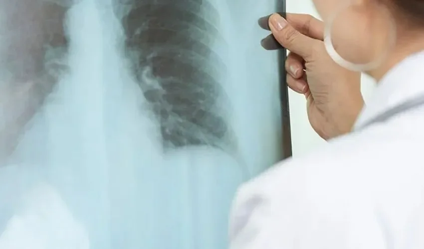 Doctores analizan una placa. 